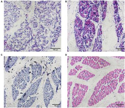 Genome-wide characteristics and potential functions of circular RNAs from the embryo muscle development in Chengkou mountain chicken